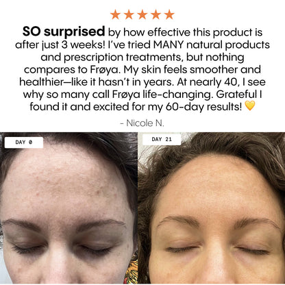 La gamme complète anti-âge naturel - FROYA ORGANICS